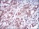 ZEB1 Primary Antibody MP30548 [M2A8H3]