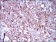 SYCP3 Primary Antibody MP30554 [M6F9C5]