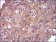 DIS3L2 Primary Antibody MP30562 [M6C7B2]