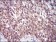 DIS3L2 Primary Antibody MP30562 [M6C7B2]
