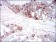 IGFBP7 Primary Antibody MP30565 [M1D9E7]