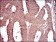 CD93 Primary Antibody MP30568 [M2F7D11]