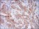 CD10 Primary Antibody MP30576 [M7D4B1]