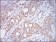 CD10 Primary Antibody MP30576 [M7D4B1]