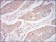 CD10 Primary Antibody MP30578 [M5E9A5]