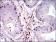 PTPRC Primary Antibody MP30586 [M2C10C11]
