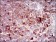 CSF1R Primary Antibody MP30589 [M6B9B9]