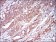 CSF1R Primary Antibody MP30594 [M6B9H2]