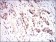 NFE2L2 Primary Antibody MP30597 [M1A6G6]