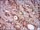 NBN Primary Antibody MP30608 [M7E4C2]