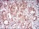 NBN Primary Antibody MP30612 [M7E4A2]