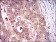 CDKN2A Primary Antibody MP30616 [M1D7D2A1]