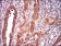 CDKN2A Primary Antibody MP30616 [M1D7D2A1]