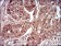 DAPK3 Primary Antibody MP30634 [M4H4C8]