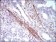 CNN1 Primary Antibody MP30636 [M1H5B5]