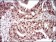 DAPK3 Primary Antibody MP30641 [M2H1D11]