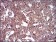 CAV2 Primary Antibody MP30645 [M5E9E2]