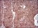 MMEL1 Primary Antibody MP30647 [M2D2H5]