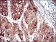 MAP2K5 Primary Antibody MP30650 [M5H11B10]