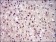 PPP1CB Primary Antibody MP30653 [M6G10C1]