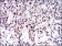 CTNNBL1 Primary Antibody MP30656 [M1E4F5]