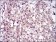 RANBP9 Primary Antibody MP30670 [M6E10H5]