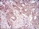 RANBP9 Primary Antibody MP30670 [M6E10H5]