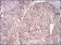 FTL Primary Antibody MP30672 [M6E10E4]