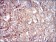 FTL Primary Antibody MP30679 [M8E1E7]