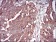 EIF2AK2 Primary Antibody MP30680 [M6H3A10]