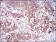 EIF2AK2 Primary Antibody MP30680 [M6H3A10]