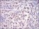 XRCC6 Primary Antibody MP30686 [M2F7F5]