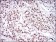 XRCC6 Primary Antibody MP30686 [M2F7F5]