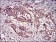 CSNK2B Primary Antibody MP30691 [M2F12F3]