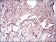VIL1 Primary Antibody MP30692 [M5E3B2]