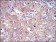 RPS6KA2 Primary Antibody MP30694 [M3C4C8]