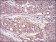 RPS6KA2 Primary Antibody MP30694 [M3C4C8]