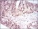 HSF1 Primary Antibody MP30696 [M4D5F4]