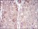 VTN Primary Antibody MP30697 [M1G11E8]