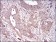 VTN Primary Antibody MP30697 [M1G11E8]