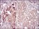VIL1 Primary Antibody MP30700 [M3E5G11]
