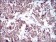 PTPN1 Primary Antibody MP30702 [M4F8F11]