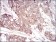 SERPINA3 Primary Antibody MP30708 [M5G3C11]