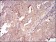 SERPINA3 Primary Antibody MP30708 [M5G3C11]