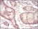EIF5A Primary Antibody MP30713 [M4E10G8]
