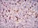 WAS Primary Antibody MP30716 [M7B10E4]