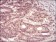 PKN1 Primary Antibody MP30717 [M4H10B1]