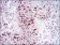 HDAC10 Primary Antibody MP30734 [M3B6B8]