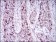 HDAC10 Primary Antibody MP30734 [M3B6B8]