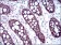 CDH17 Primary Antibody MP30737 [M7D10E1]